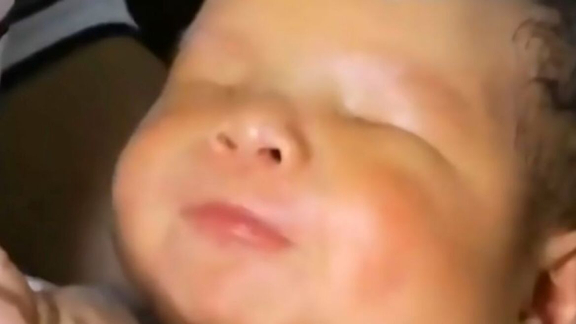 Μωρό στην Κίνα γεννήθηκε χωρίς μάτια
